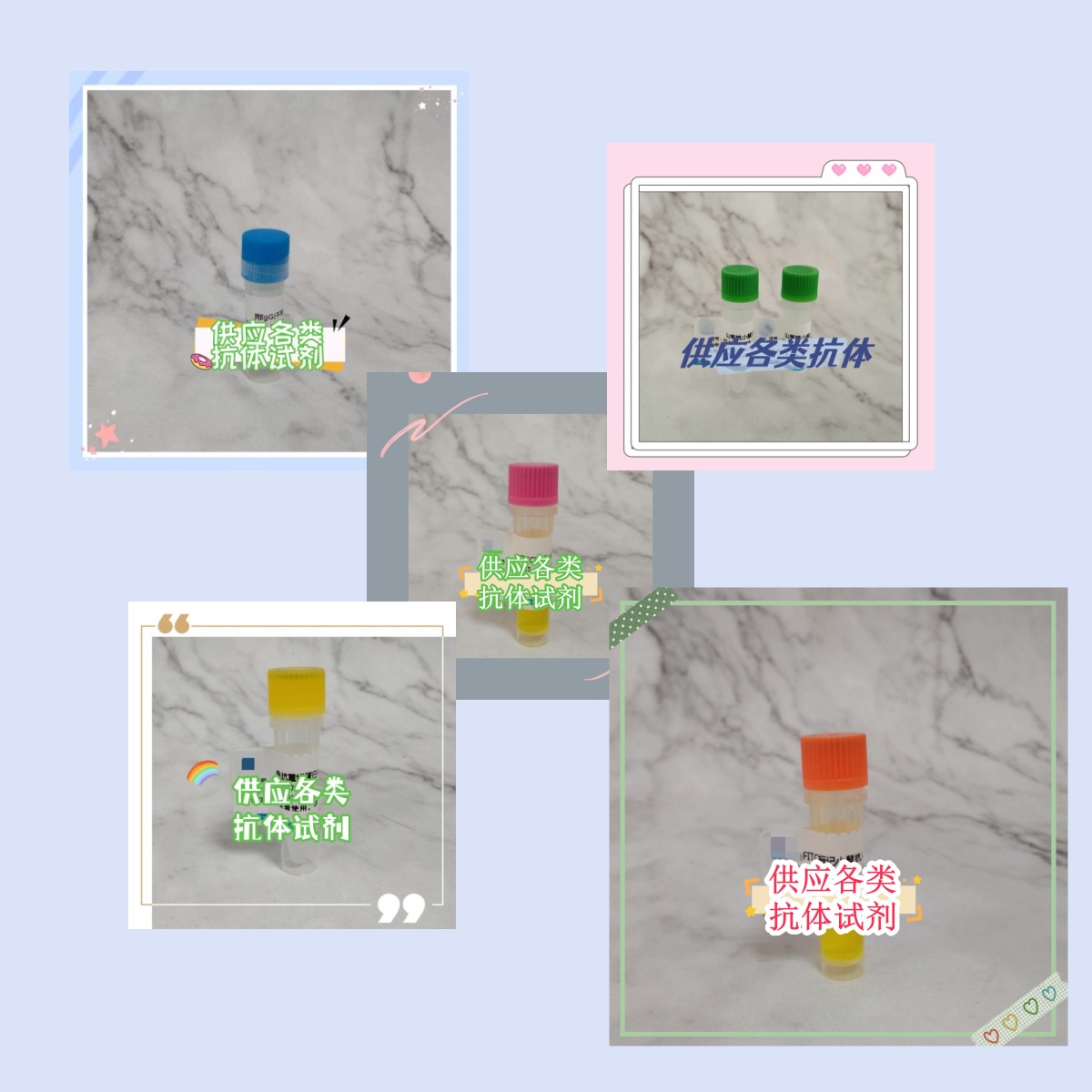 小鼠抗人IgA单克隆抗体 高特异性抗体