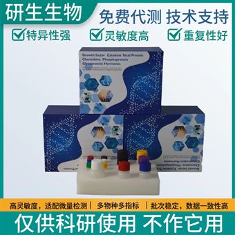 小鼠水通道蛋白1（AQP-1）elisa酶聯(lián)免疫試劑盒實(shí)驗(yàn)方法