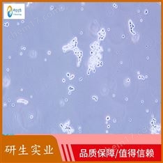 魚脾淋巴細胞規(guī)格
