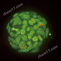 CSU-W1雙轉(zhuǎn)盤共聚焦掃描單元