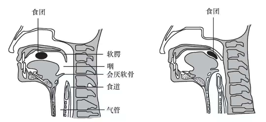 質構測試：吞咽困難患者的食物特性