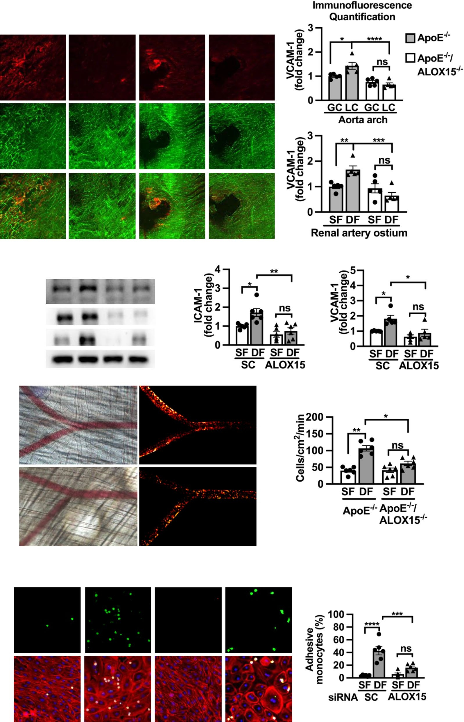 12/15-脂氧合酶介导血流紊乱诱导的内皮功能障碍与动脉粥样硬化