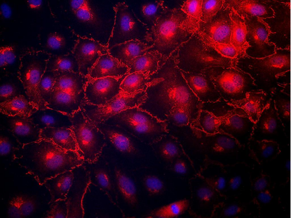 LONZA原代人主动脉内皮细胞HAEC, Human Aortic Endothelial Cells产品介绍