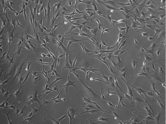 image.png LONZA原代人主動脈平滑肌細胞HAoSMC/HASMC 產品介紹